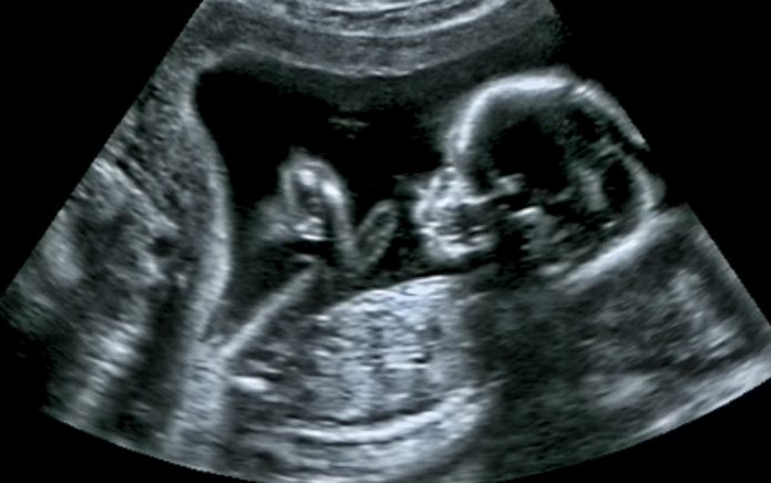 19_1021_DISCIPLESHIP_Why Being Pro-Life Is About More Than Just Being Anti-Abortion_1021x640
