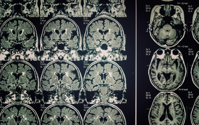 21_0318_DISCIPLESHIP_How Neuroscience Informs Discipleship